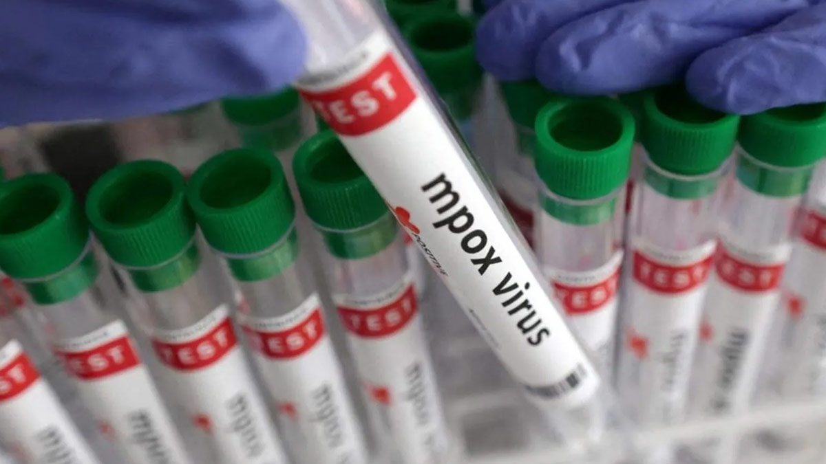 India Records First Suspected Mpox Case, Patient In Isolation